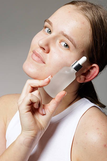 skin texture improvement with retinoid use showing reduced fine lines and smoother complexion Retinol vs Retinoid