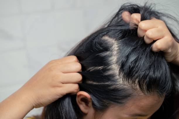 Examples of oily dry sensitive and healthy scalp types
