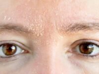How to Repair a Damaged Skin Barrier (And Why Yours Might Be Broken Right Now)