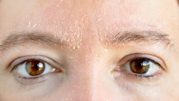 How to Repair a Damaged Skin Barrier (And Why Yours Might Be Broken Right Now)