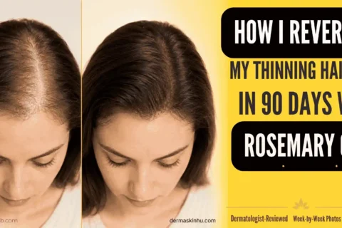 How I Reversed My Thinning Hairline in 90 Days With Rosemary Oil